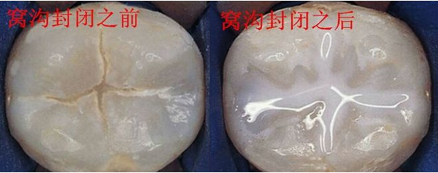 微信截图_20190412143600.png
