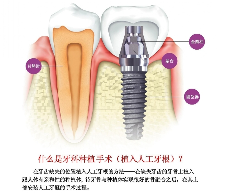 QQ图片20170105091902.png