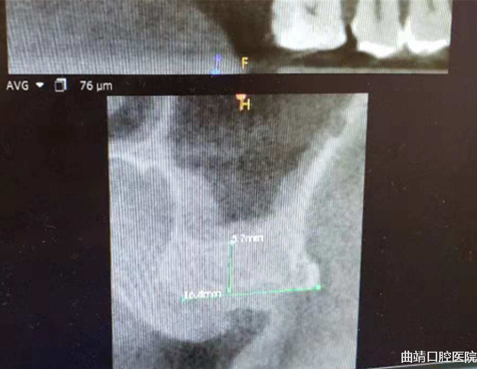 微信截图_20181214093504.png